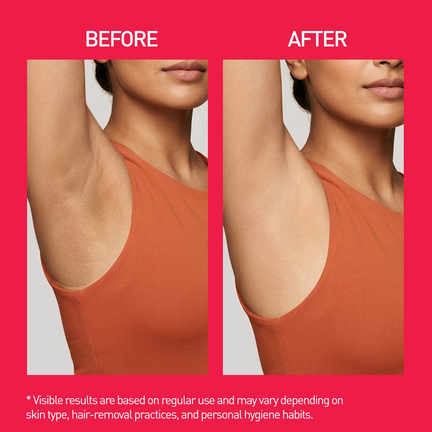 Underarm Roll-On - 50ml