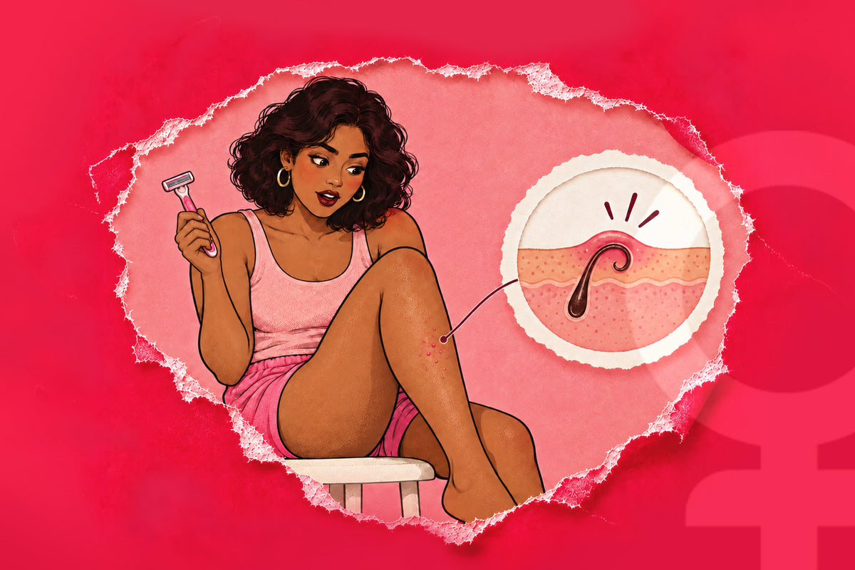 Nobody Told Me Shaving Could Cause Bumps: The Truth About Razor Bumps