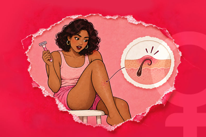 Nobody Told Me Shaving Could Cause Bumps: The Truth About Razor Bumps