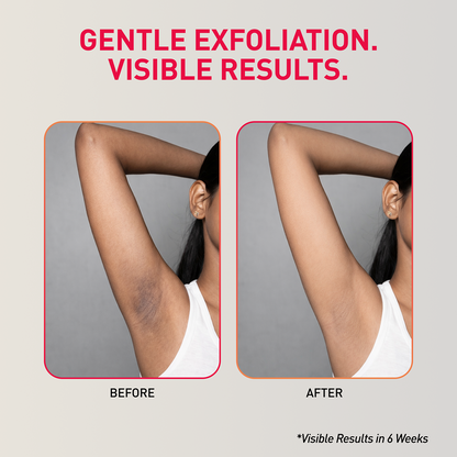 Before and after comparison of a person&