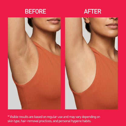 Underarm Roll-On - 50ml