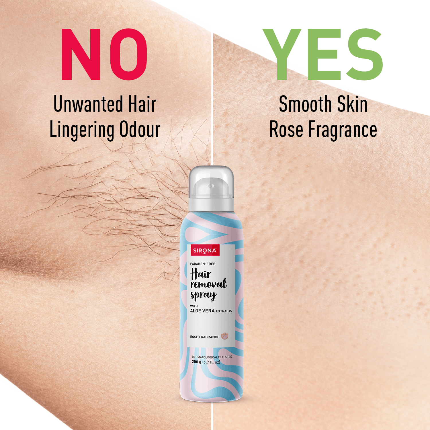 Sirona Hair Removal Spray Foam with Aloe Vera Extracts and Rose Fragrance | For Legs, Arms &amp; Underarms | Removes Hair in 10 Minutes | Parabens Free | Dermatologically Tested | 200 ml