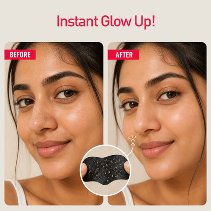 Bamboo Charcoal Nose Strips