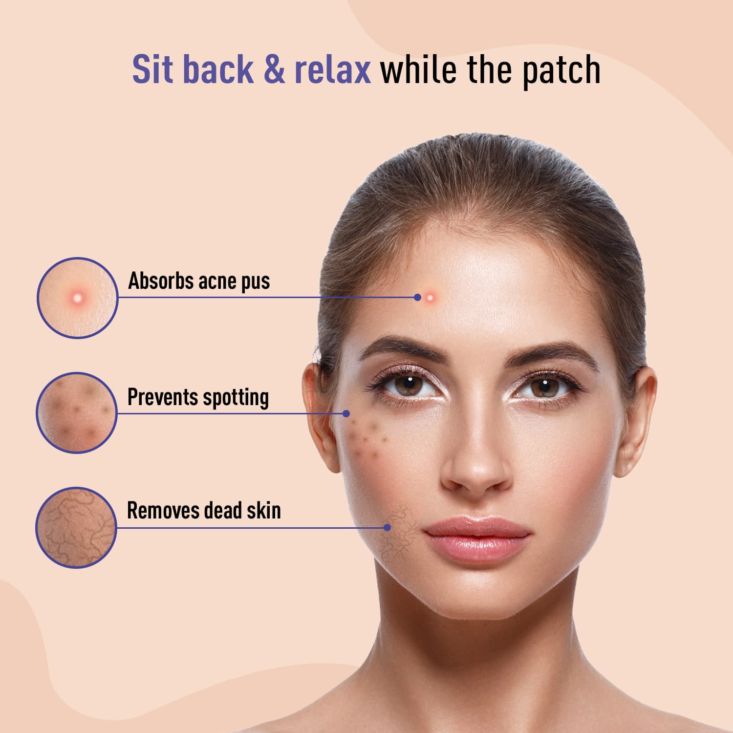 Sirona Acne Pimple Patch For Face (72 patches) | 2 sizes | Invisible, Concealable, Waterproof Patches | Hydrocolloid &amp; Salycylic Acid | Absorbs Acne Pus | Flattens Pimple | For All Skin Types